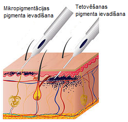 Atšķirības starp pigmenta ievadīšanas dziļumu ādā mikropigmentācijas un tetovēšanas procedūrā.