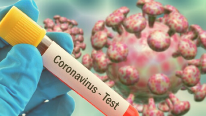 Bilde ar Covid-19 testu